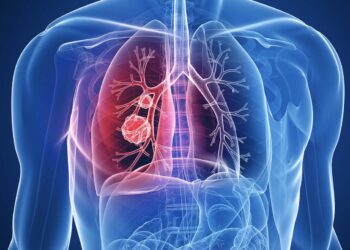 BioNtech nis testet klinike te njerëzit për vaksinën kundër kancerit të mushkërive