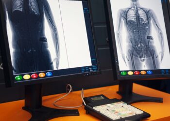 Tenderi 6.2 mln euro i sigurisë në burgje kthehet në mollë sherri në KPP, akuza për favorizim të AlbaScan dhe Advanced Business Solutions