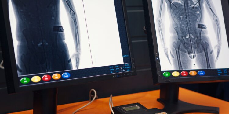 Tenderi 6.2 mln euro i sigurisë në burgje kthehet në mollë sherri në KPP, akuza për favorizim të AlbaScan dhe Advanced Business Solutions