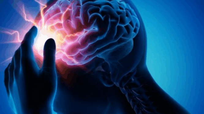 Në Shqipëri 1 në 4 persona  pëson goditje në tru