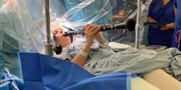 VIDEO/ Pacientja me Parkinson i bie klarinetës gjatë operacionit në tru