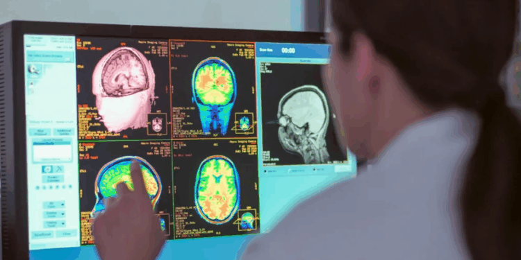 Adoleshenca zgjat deri në të 30-at, studimi i ri zbulon periudhat kyçe të trurit: Kur arrihet “pjekuria”