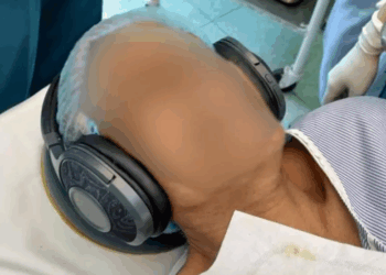 Pacientët me kufje në vesh nën anestezi, studimi: Zgjohen më shpejt pas operacionit kur dëgjojnë muzikë