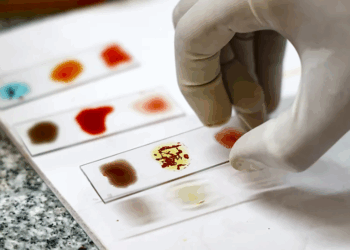 Lloji më i rrallë i gjakut në botë që shkencëtarët po përpiqen ta krijojnë në laborator