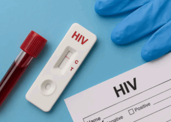 Shqipëria ndër vendet me përqindjen më të lartë të diagnostikimeve të vonshme të HIV