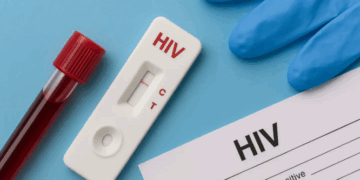 Shqipëria ndër vendet me përqindjen më të lartë të diagnostikimeve të vonshme të HIV