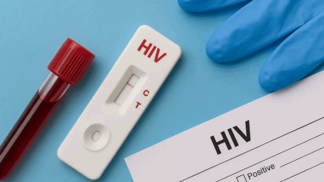 Shqipëria ndër vendet me përqindjen më të lartë të diagnostikimeve të vonshme të HIV