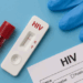 Shqipëria ndër vendet me përqindjen më të lartë të diagnostikimeve të vonshme të HIV