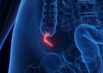 Një lloj i rrallë kanceri po shfaqet tek të rinjtë