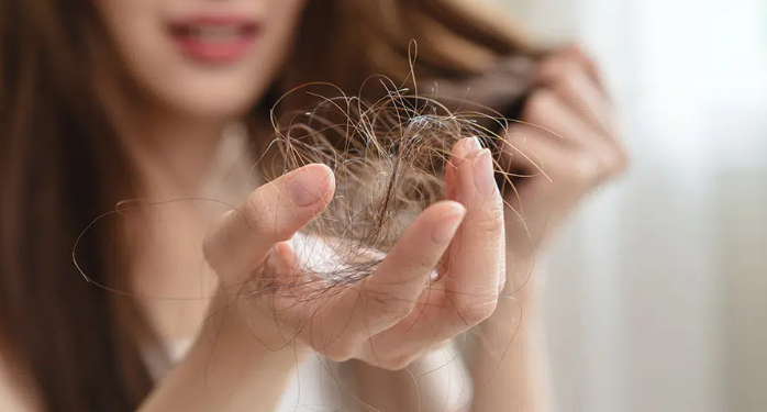 Cilat janë shkaqet e rënies së flokëve?