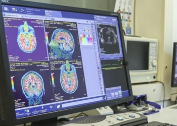 Analiza e gjakut zbulon ndryshimet në tru që lidhen me Alzheimerin