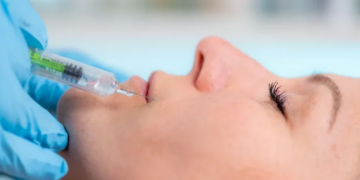 Ekspertët paralajmërojnë rreziqe nga injektimet estetike në fytyrë