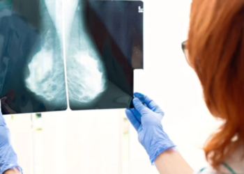 Revolucion në trajtimin e kancerit të gjirit, testi i ri përcakton trajtimin më efektiv për pacientin