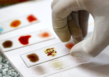 Çfarë është “gjaku i artë”, rrjedh në venat e 50 njerëzve në botë?