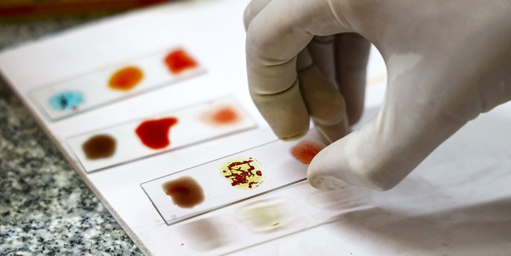 Çfarë është “gjaku i artë”, rrjedh në venat e 50 njerëzve në botë?