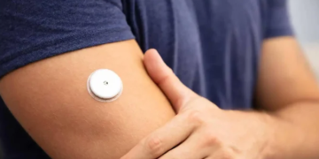 “Revolucion” në trajtimin e diabetit, një implant inovativ premton fundin e injektimeve të insulinës