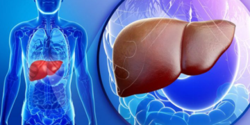 Sëmundja e heshtur e mëlçisë që po prek miliona njerëz