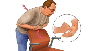 Çfarë është manovra Heimlich, shpëton jetën nga mbytja