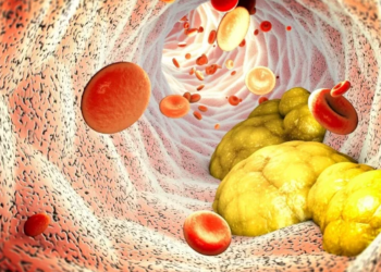 Studimet sfidojnë mitin, kolesteroli i lartë ndikon në jetëgjatësinë e të moshuarve