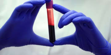 Një test gjaku për zbulimin e dhjetëra lloje kanceri