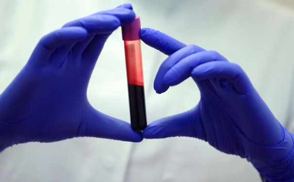 Një test gjaku për zbulimin e dhjetëra lloje kanceri