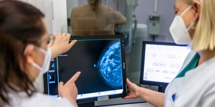 Në tre dekadat e fundit kanceri i gjirit është rritur me 29% tek gratë e reja. Pse ndodh kjo?