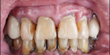 Merruni me dhëmbët tuaj ose do të vdisni më shpejt