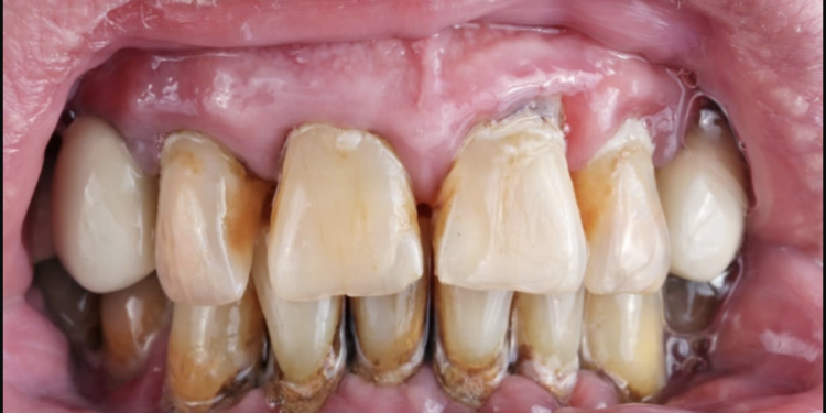 Merruni me dhëmbët tuaj ose do të vdisni më shpejt