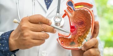 Shpresë për parandalimin e kancerit të stomakut