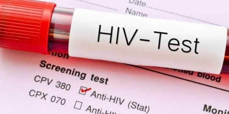 Valë e re infeksionesh me HIV në Shqipëri gjatë 2025, rekord që nga 2016