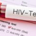 Valë e re infeksionesh me HIV në Shqipëri gjatë 2025, rekord që nga 2016