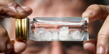 Cili është pickimi më i dhimbshëm në botë?