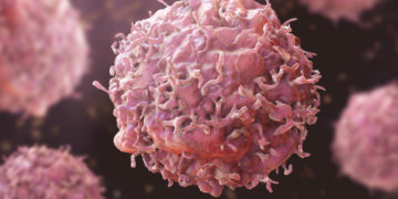 11 lloje kanceri në rritje te të rinjtë, shkencëtarët zbulojnë një prej shkaqeve