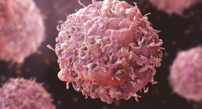 11 lloje kanceri në rritje te të rinjtë, shkencëtarët zbulojnë një prej shkaqeve