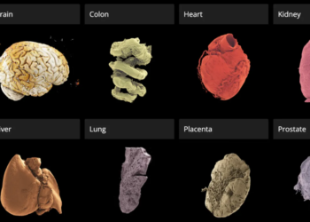 Skanimi i plotë i trupit në 3D do të realizohet shumë shpejt