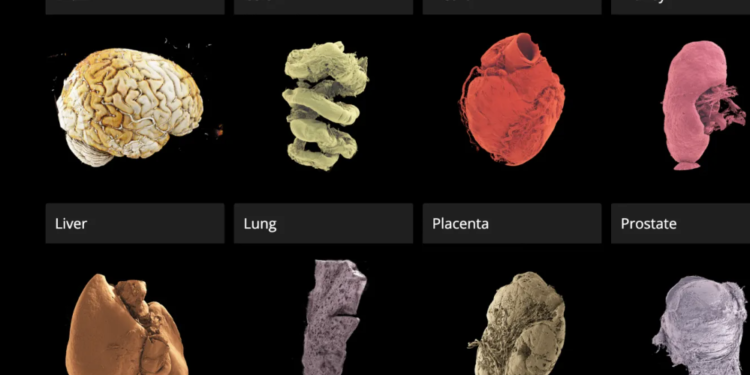 Skanimi i plotë i trupit në 3D do të realizohet shumë shpejt