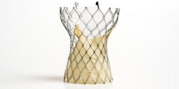 Çfarë duhet të dinë pacientët me probleme të valvulës së zemrës përpara trajtimit