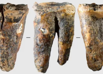 Neandertalët mund të kenë kryer ndërhyrjen e parë dentare 59 mijë vjet më parë