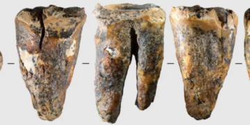 Neandertalët mund të kenë kryer ndërhyrjen e parë dentare 59 mijë vjet më parë