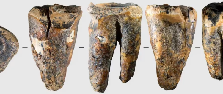 Neandertalët mund të kenë kryer ndërhyrjen e parë dentare 59 mijë vjet më parë