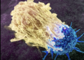 Një virus eksperimental godet kancerin e pankreasit, por mjekët kërkojnë KUJDES!