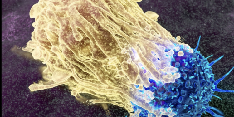 Një virus eksperimental godet kancerin e pankreasit, por mjekët kërkojnë KUJDES!