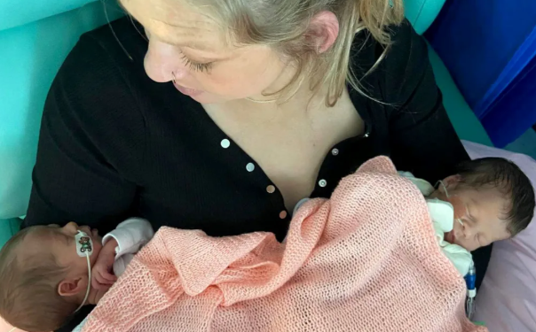 Trajtimi pioner shpëton binjaket identike nga një komplikacion i rrallë i shtatzënisë