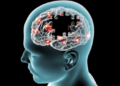 Pse terapia nuk funksionon njësoj për të gjithë pacientët me Parkinson?