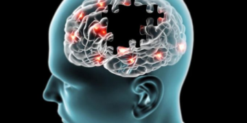 Pse terapia nuk funksionon njësoj për të gjithë pacientët me Parkinson?