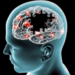 Pse terapia nuk funksionon njësoj për të gjithë pacientët me Parkinson?