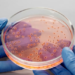Viruset po mësojnë si t’i mposhtin bakteret rezistente ndaj antibiotikëve