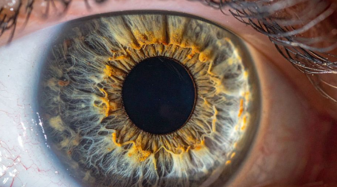 Retina zbulon sinjale të sëmundjeve, nga diabeti te hipertensioni